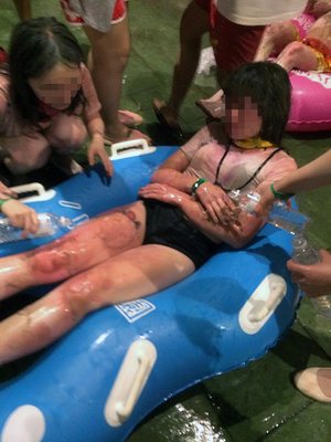 新北市遊園地で粉じん爆発、やけど431人