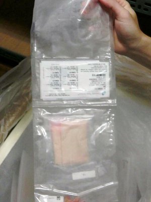 粉塵爆発被害者へと皮膚が続々到着