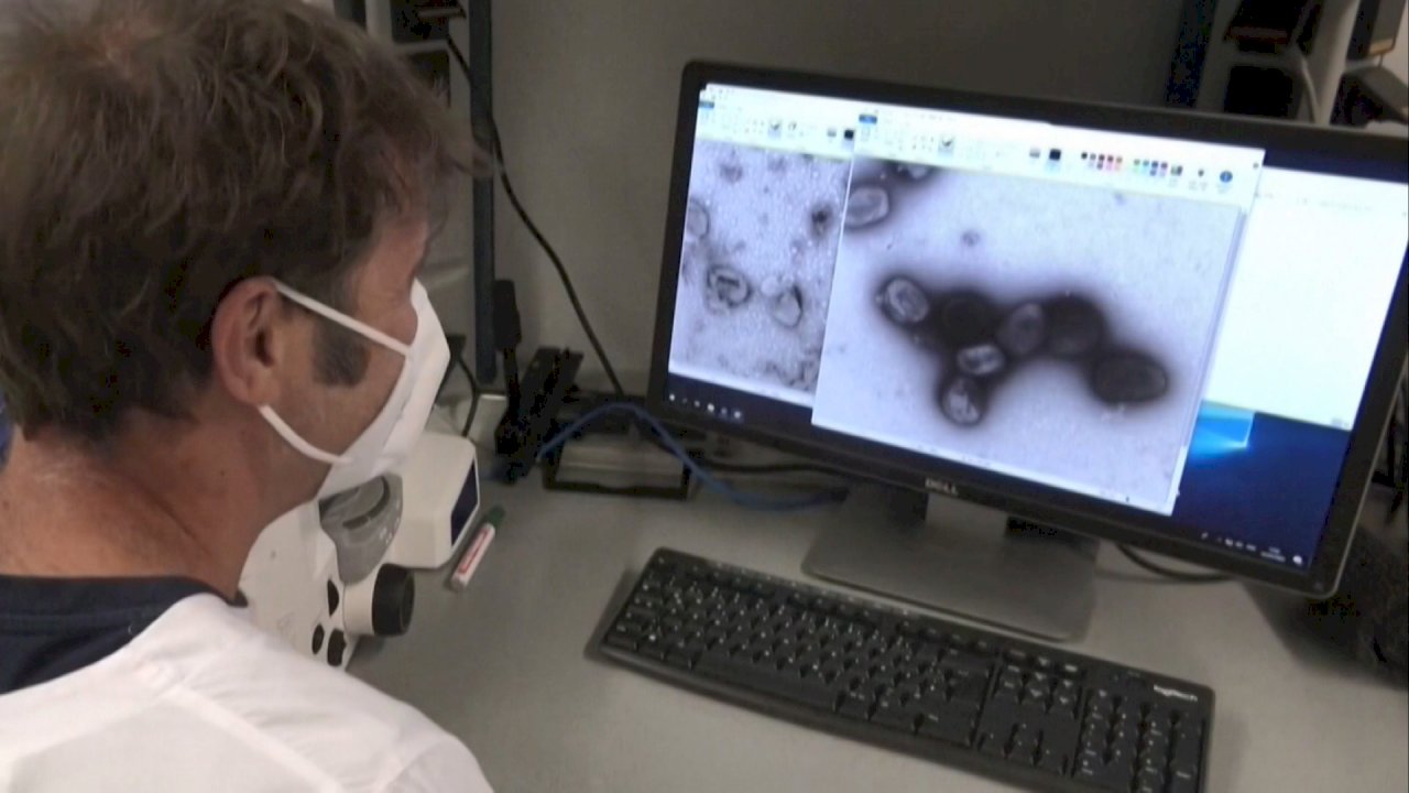 サル痘感染者世界で3000例超、医師：3大リスク群は注意が必要
